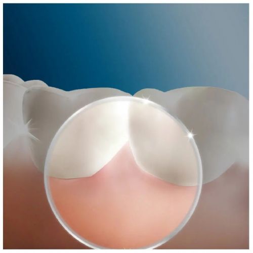 Zobna prha Oral-B Munddusche Oxyjet JAS23